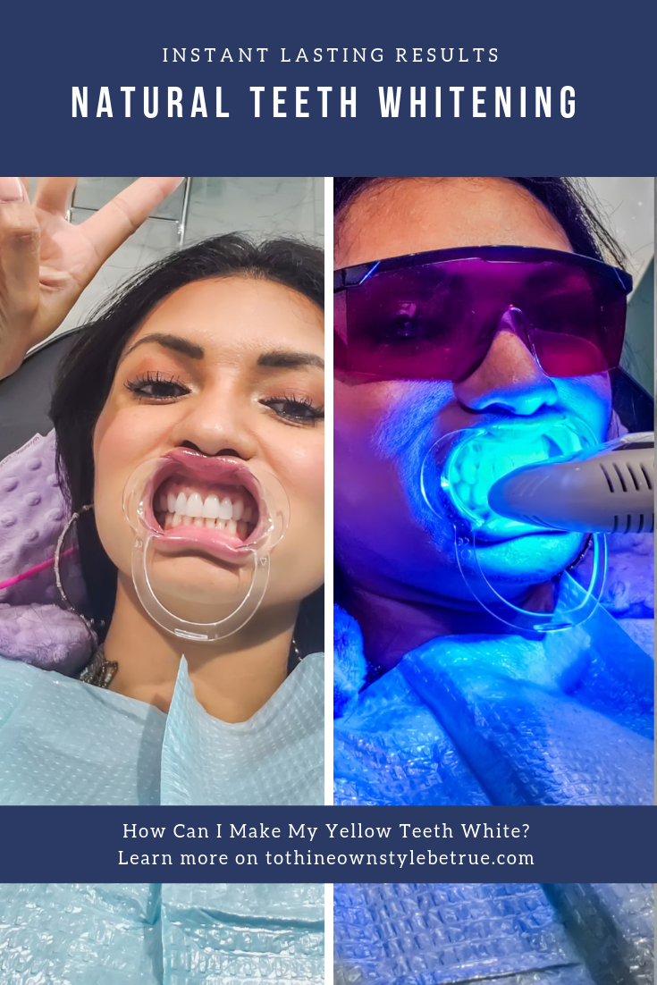 Curious how to whiten your teeth and achive a bright white smile? Orange County Blogger Debbie Savage is sharing how to whiten yellow teeth in a flash.  Click to see here Naturally White OC experience. 